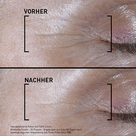 Filorga TIME-FILLER SHOT 5XP Serum zur Korrektur von Mimikfalten