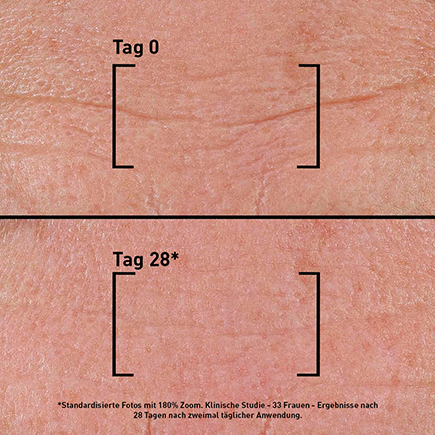 Filorga TIME-FILLER INTENSIVE 5XP Intensiv glättendes Serum
